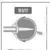 [Healthy Life] 멀리 있는 사물 흐려보이면 의심을