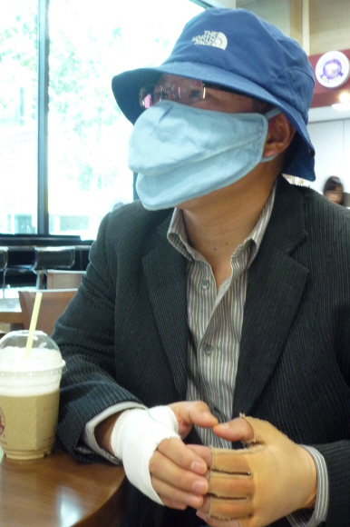 지난해 12월 경기 이천 물류창고 화재 현장에서 구조작업을 벌이다 얼굴과 팔등에 2~3도 화상을 입고 치료를 받고 있는 중앙119구조대 김진태 소방장이 9일 그간의 소회를 털어놓고 있다. 