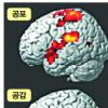 사이코패스 치료 길 열린다