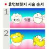 휴먼브릿지 시술은…이물감 1~2일 지나면 사라져