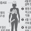 미확인 바이러스성 폐렴환자 첫 사망