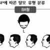 한국인형 탈모 새 분류 나왔다