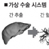肝수술 부위 3차원화… 30분만에 가상수술 정보제공