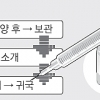 日서 한국인에 안전검증 안된 줄기세포 시술… 新마루타?