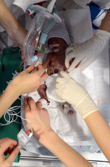 연세대학교 세브란스 병원에서 한 이른둥이가 동맥관개존증이란 질환으로 수술 준비를 하고 있다. 0.4㎜의 혈관을 꿰매야 하는 고난도의 수술이다.