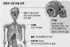 故장준하 선생 유골 주삿바늘의 정체는