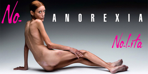 13살부터 거식증을 앓은 프랑스 모델 이사벨 카로. 2010년에 결국 숨졌다.