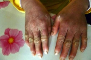 이렇게 힘들었는데…강제북송 된 10대 소녀의 손