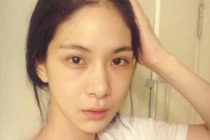 노시현 앓고 있다는 ‘스트레스성 우울증’ 혹시 나도?