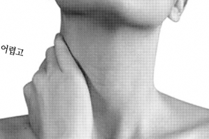 반갑잖은 갑상선 기능항진증