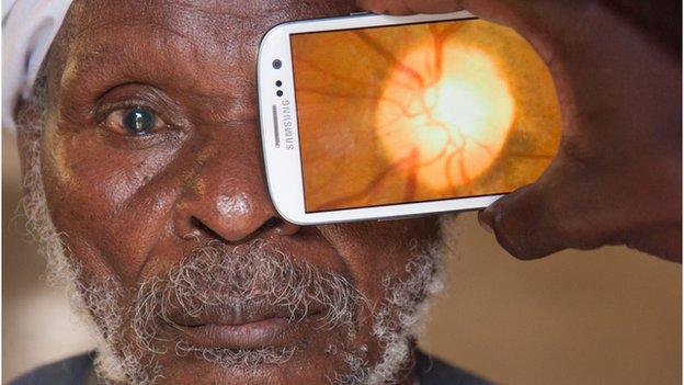아프리카 케냐의 노인이 스마트폰으로 백내장 검사를 하고 있다. 의료기술이 진전될수록 의사와 환자의 정보교환은 더욱 중요해진다. BBC홈페이지