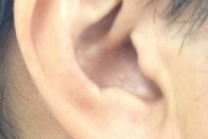 귀! 열어라… “지켜야 잡는다” 감기약 먹는 법