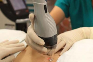 감추고 싶은 내 흉터… 흔적없이 다시 활짝 웃고 싶다면