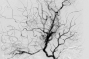 모야모야병 여대생 한달 만에 의식회복…범죄피해 1000만원 지원