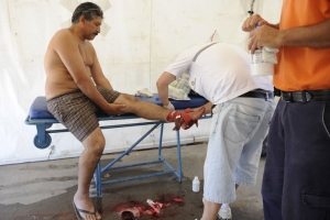 물놀이 도중 피라냐 출현해 70여명 부상 ‘경악’