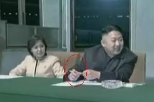 北김정은은 고도 비만?…건강상태 예측해보니