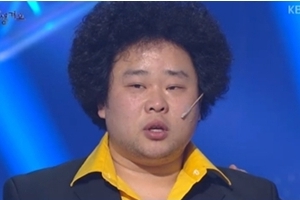 송영길 성형수술 고백 “눈-코 해서 400만원 들었다” 충격