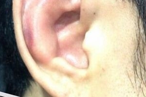 윤형빈 귀모양, 얼마나 연습했으면..‘귀 모양까지 변했다’