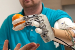 촉감 살린 ‘인공 손’ 세계 첫 임상시험 성공