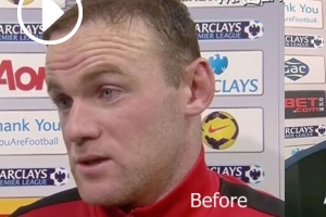 웨인 루니가 보톡스 주사를? 주름 사라진 ‘비포 & 애프터’ 영상 화제