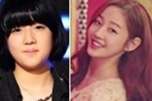 슈스케2 박보람 다이어트, 양악수술 했나 봤더니..‘4년만에 180도 변신’
