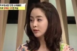 렛미인 레전드 허예은, 양악수술 후 다시 태어난 미모.. 전후 비교 ‘경악’