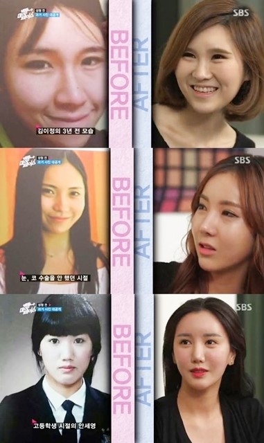 SBS 백투마이페이스