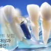 임플란트 보험적용대상과 그 비용은?
