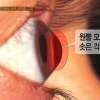 PD수첩, 라식 라섹 부작용 보도 “부작용보다 가격할인 초점” 충격적 증언