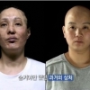 ‘렛미인’ 괴물엄마 송혜정씨, 성형수술의 진정한 의미 되찾다…렛미인4 ‘털 없는 엄마’ 김현수씨도 감동