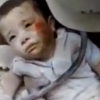시리아 정부군 공습에 묻힌 아이 극적 구조