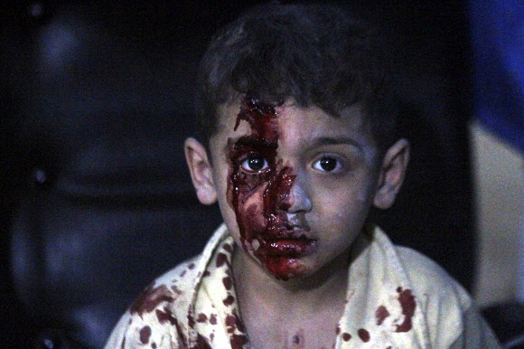 미국의 4차례 시리아 내 IS 공습이 있었던 24일(현지시간) 공습으로 부상 당한 아이가 피를 흘리며 병원으로 이송돼 안정을 취하고 있다.  AP=연합