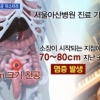 故 신해철 부검 결과, “수술 후 10분도 못 자” 비명까지 질렀던 상황까지..