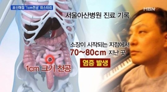 故 신해철 부검 결과. MBN 영상캡쳐