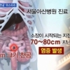 신해철 눈물 “심장 충격 가할 때 왼쪽 눈꼬리 옆으로 눈물 흘러”