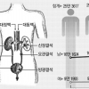 소변 횟수 부쩍 늘거나 혈뇨 땐 요로결석 의심