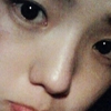 파랑새의 집 채수빈, 시퍼렇게 멍든 얼굴+이해할 수 없는 표정 ‘왜?’