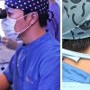 라식, 라섹수술 하기 전 병원 결정에 있어 가장 중요한 요소는?