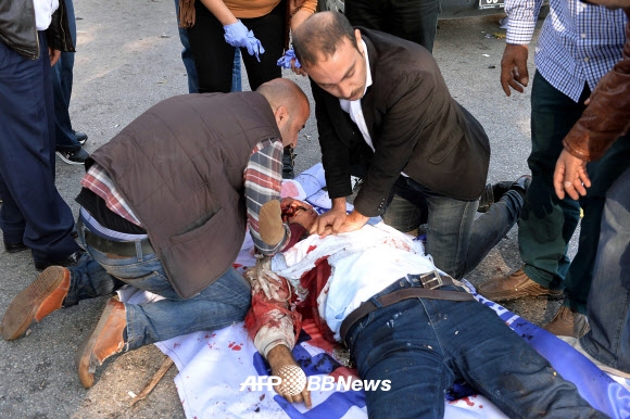 10일(현지시간) 터키 수도 앙카라 중앙역에서 폭탄 테러로 추정되는 폭발이 발생, 부상자를 시민들이 지혈하고 있다. 이날 폭발로 최소 30명이 사망했다. ⓒ AFPBBNews=News1