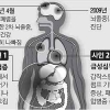 사인 패혈증·급성심부전증