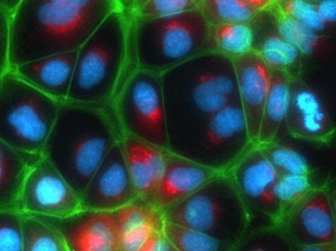 이스라엘과 독일 과학자들이 실험실에서 간 세포를 만들어 증식시키는 데 성공했다. 사진은 연구진이 만든 간세포가 형광으로 염색해 밝게 빛나는 모습. 이스라엘 헤브루대 제공