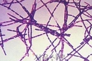북핵 보다 무서운 탄저균 공포 커지나...17㎏이면 서울인구 절반 사라져