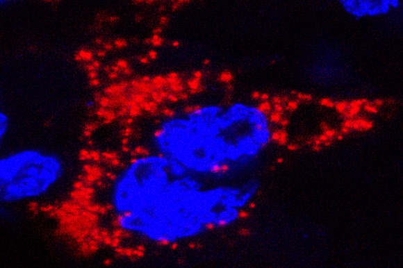 지카 바이러스가 모체의 태반을 넘어 태아에 감염될 수 있다는 동물 실험 결과가 나왔다. 사진에서 붉은 색은 태반을 이루는 세포에 지카 바이러스가 침입한 모습이고, 푸른 색은 태반 세포의 핵을 나타낸다. 사진=연합뉴스