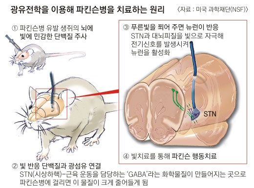 뇌에 빛 쬐여… 치매·우울증 치료한다? | 서울신문