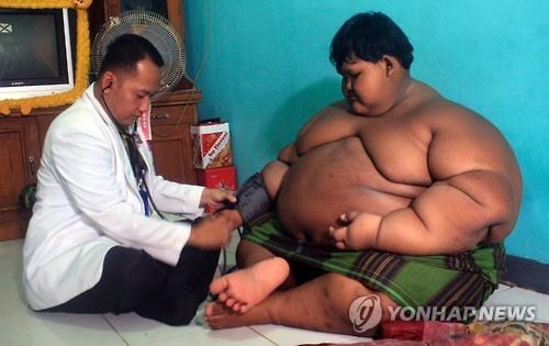 인도네시아 서부 자바주 카라왕 리젠시에서 의사가 10살 나이에 체중이 192㎏까지 불어난 아르야 퍼르마나(10)를 검진하고 있다. AFP 연합뉴스
