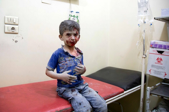 시리아 정부군이 24일(현지시간) 알레포시에 대한 공습을 단행한 가운데 피딱지와 흙먼지를 뒤집어쓴 한 어린이가 치료를 받기 위해 임시 병원에 마련된 간이침대 위에 앉아 있다. 알레포 AFP연합뉴스