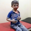 시리아, 소이탄 폭격… 무고한 아이들 매몰
