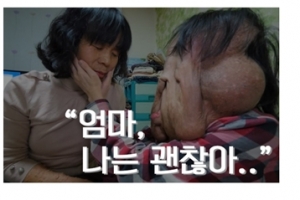 신경섬유종 심현희씨 후원금 1억 6000만원 돌파…하루에 목표액의 5배 모여