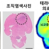 전자파 활용해 뇌종양 진단 정확도 높인다