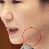 “朴대통령 세월호 당일 16일~20일 사이 피부시술 흔적”